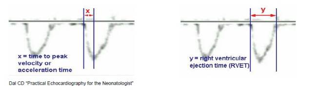 diagnosi_ipertensione_polmonare_3.jpg